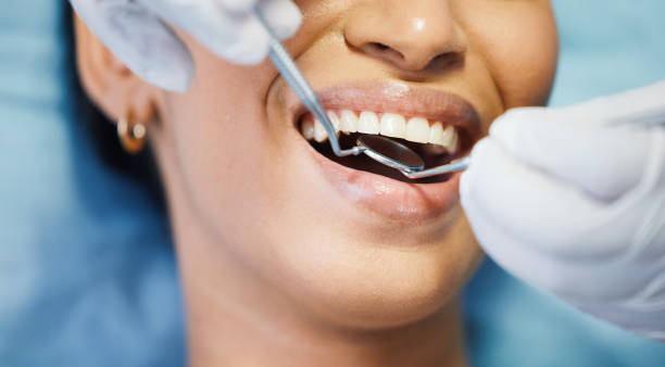 Best Emergency Dentist for Special Needs Patients in Muskegon, MI